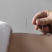 close-up-hand-holding-acupuncture-needle close-up-hand-holding-acupuncture-needle
